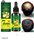 7 Days Ginger Hair Growth Oil - King Of Ginger Oil For Hair Regrowth - 30ml Ginger Germinal Oil For Baldness & Hair Fall Control