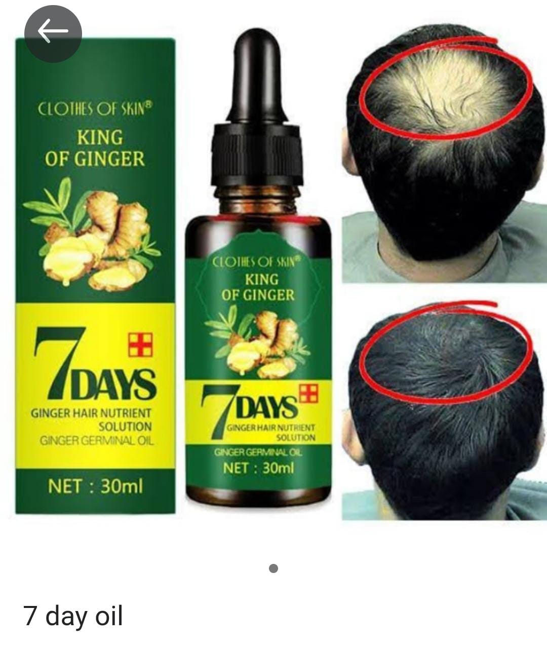 7 Days Ginger Hair Growth Oil - King Of Ginger Oil For Hair Regrowth - 30ml Ginger Germinal Oil For Baldness & Hair Fall Control